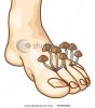 stock-vector-mycosis-between-fingers-vector-illustration-69665851.jpg